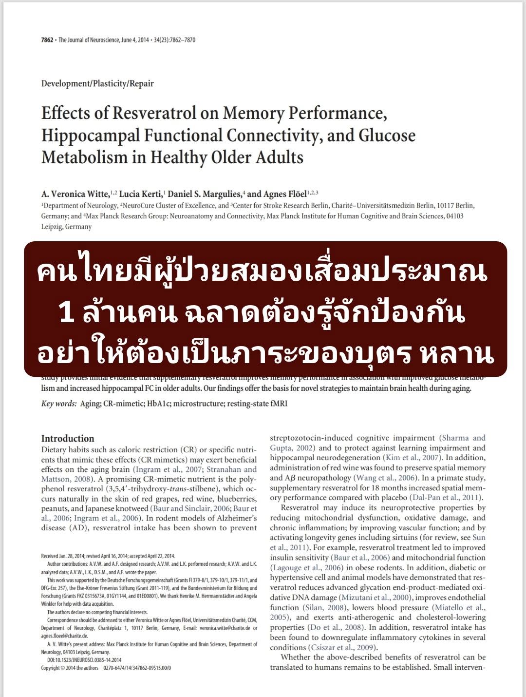 Effects of Resveratrol on Memory Performance, Hippocampal Functional Connectivity, and Glucose
