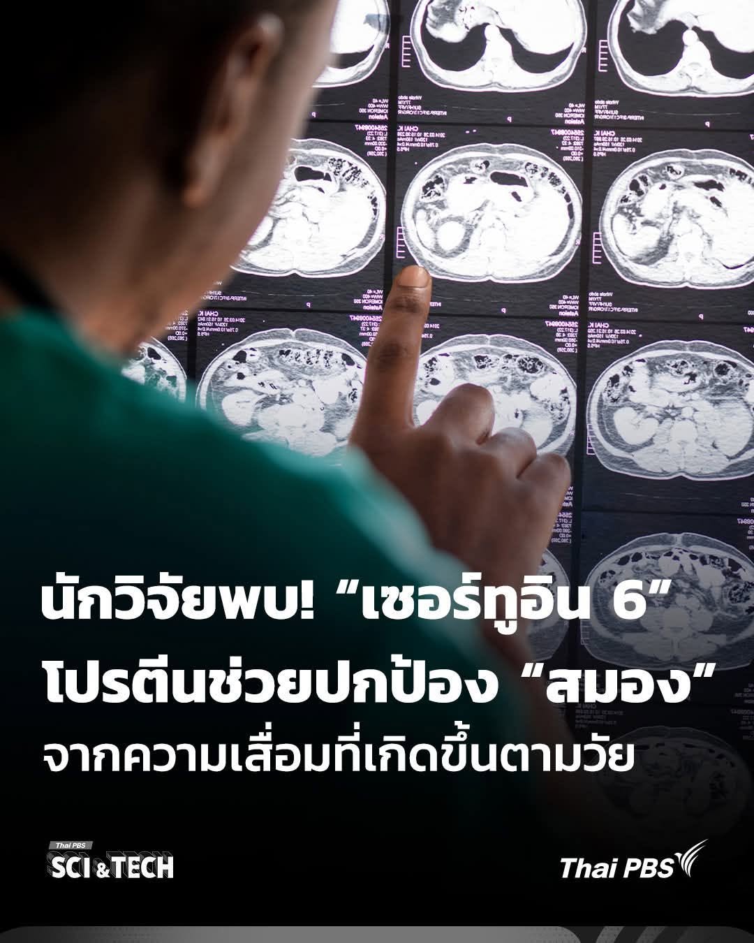 คำอธิบาย กลไกการกระตุ้นการทำงานของยีนเซอร์ทูอิน 6 (SIRTUIN6 / SIRT6) โดย เรสเวอราทรอล Dr.Vee สกัดจากมัลเบอร์รี่ ธรรมช...